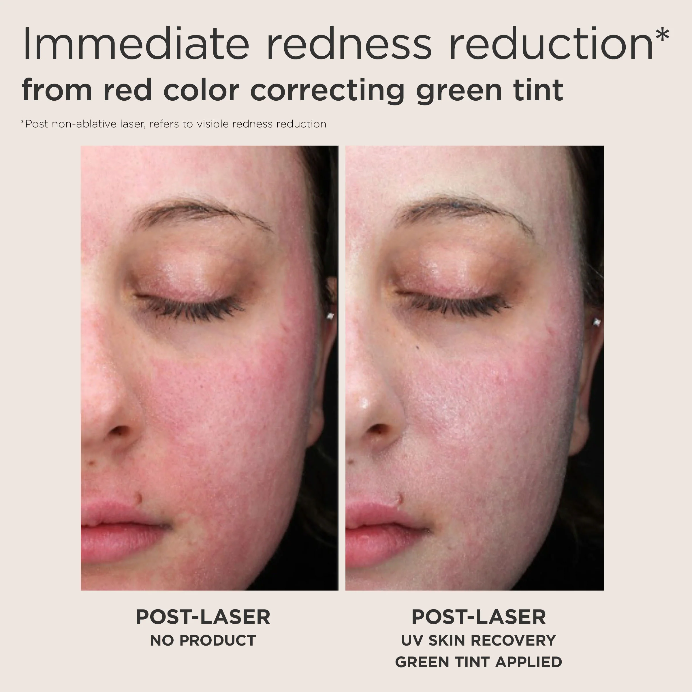 EltaMD Post-Procedure Skincare Kit - Image 6