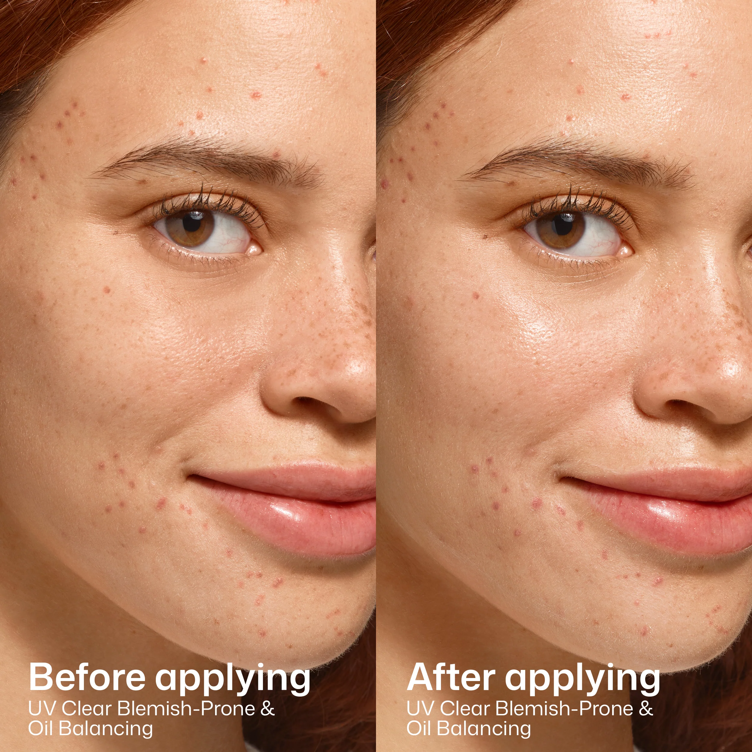 EltaMD UV Clear Blemish-Prone & Oil Balancing SPF 50 - Image 5