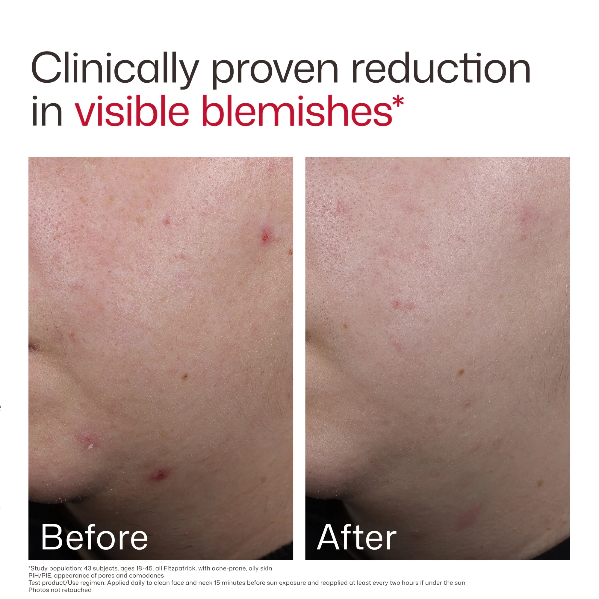 EltaMD UV Clear Blemish-Prone & Oil Balancing SPF 50 - Image 6