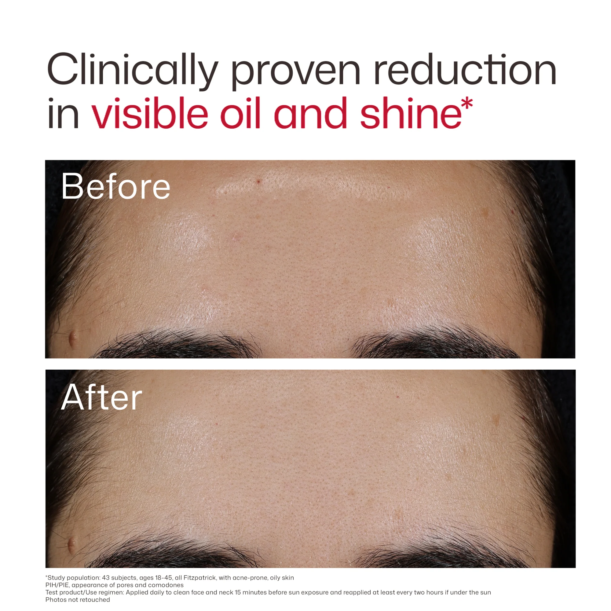 EltaMD UV Clear Blemish-Prone & Oil Balancing SPF 50 - Image 7