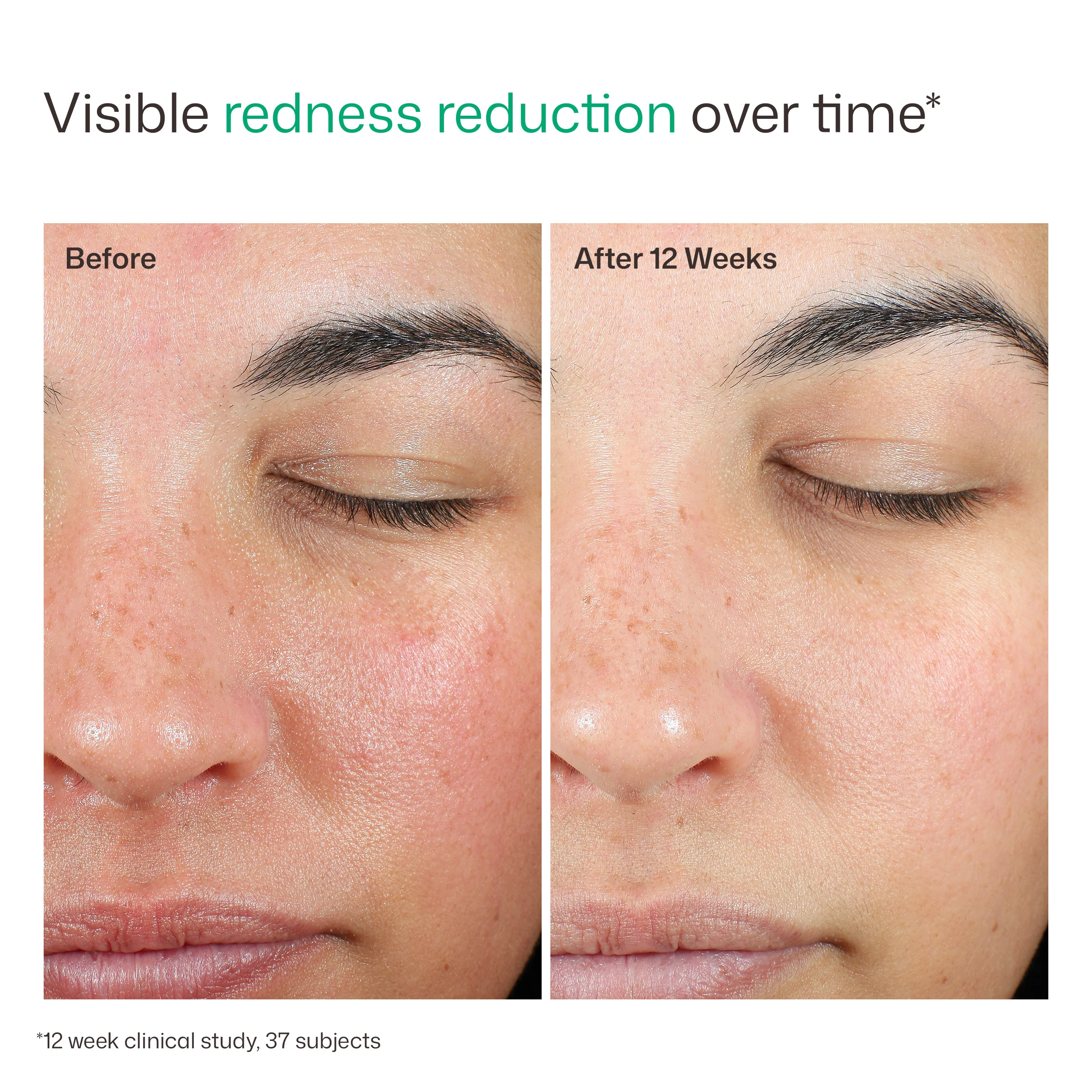 EltaMD UV Skin Recovery Red Color Correcting Green Tint Broad Spectrum SPF 50 - Image 9
