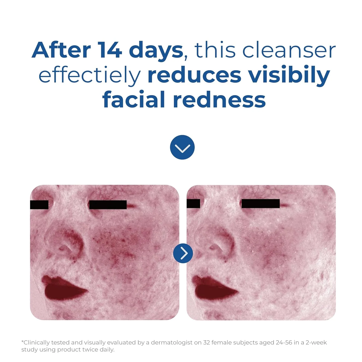 EltaMD Skin Recovery Amino Acid Foaming Cleanser - Image 6