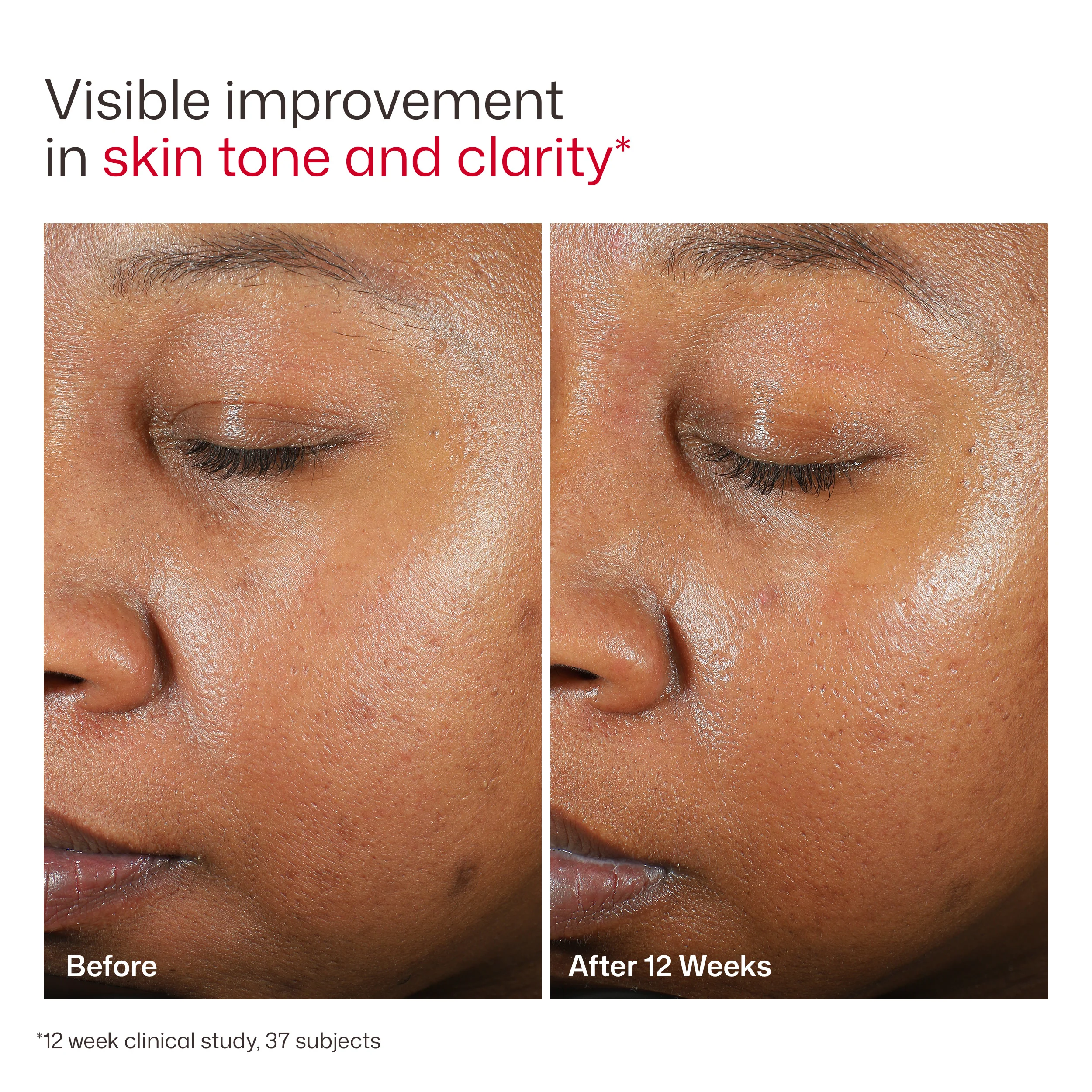 EltaMD UV Clear Broad-Spectrum SPF 46 - Image 10
